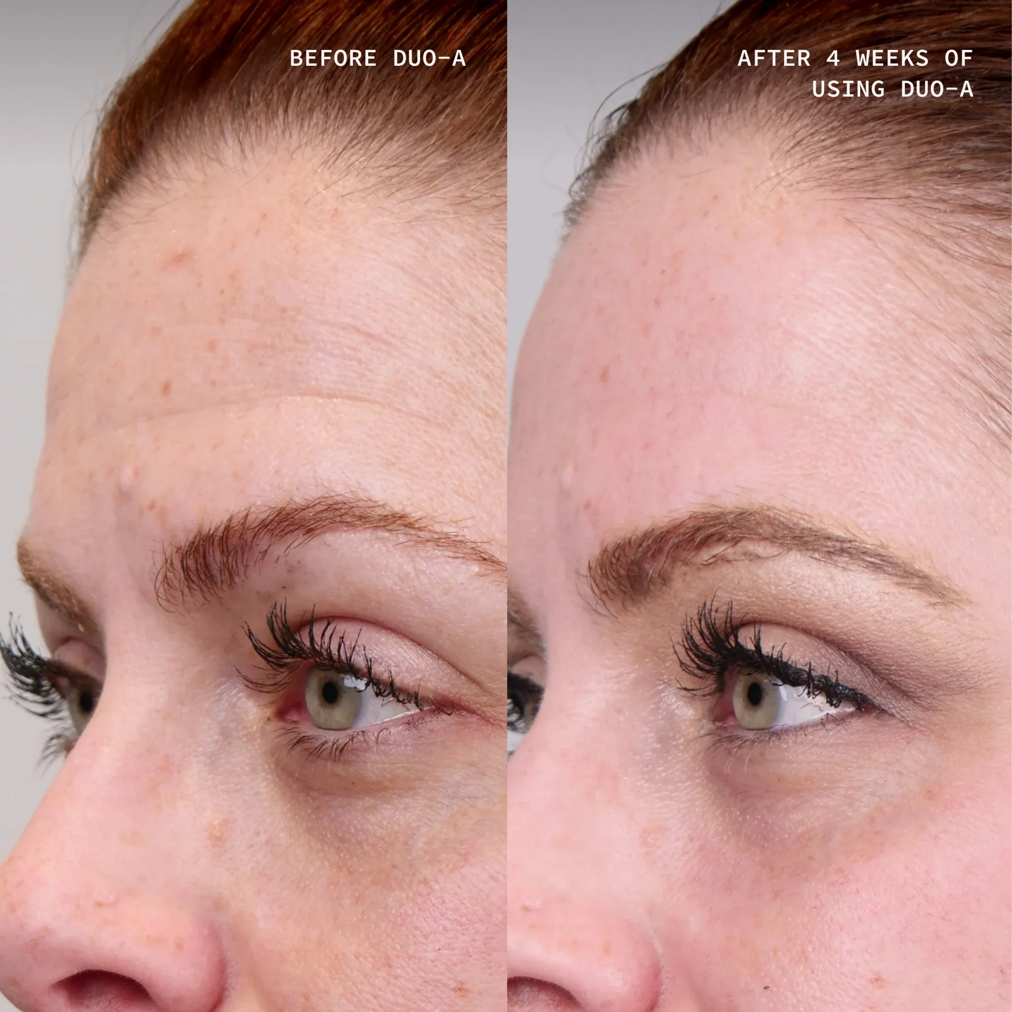 DUO-A 1% Nightly Retinoid Treatment - Image 3